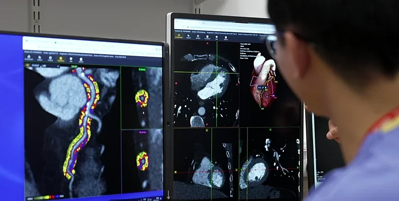 Caristo Diagnostics imaging technology